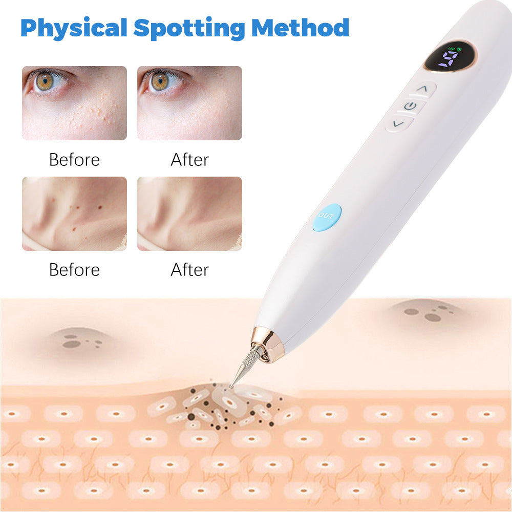 Laser Scan With Dot Nevus Pen Needle
